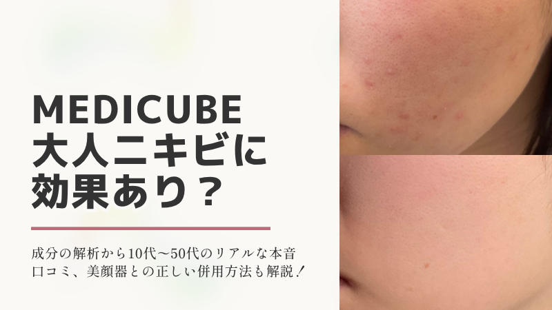 【本音レビュー】メディキューブはニキビに効果あり？10代〜50代のガチ口コミと成分を徹底検証のアイキャッチ画像